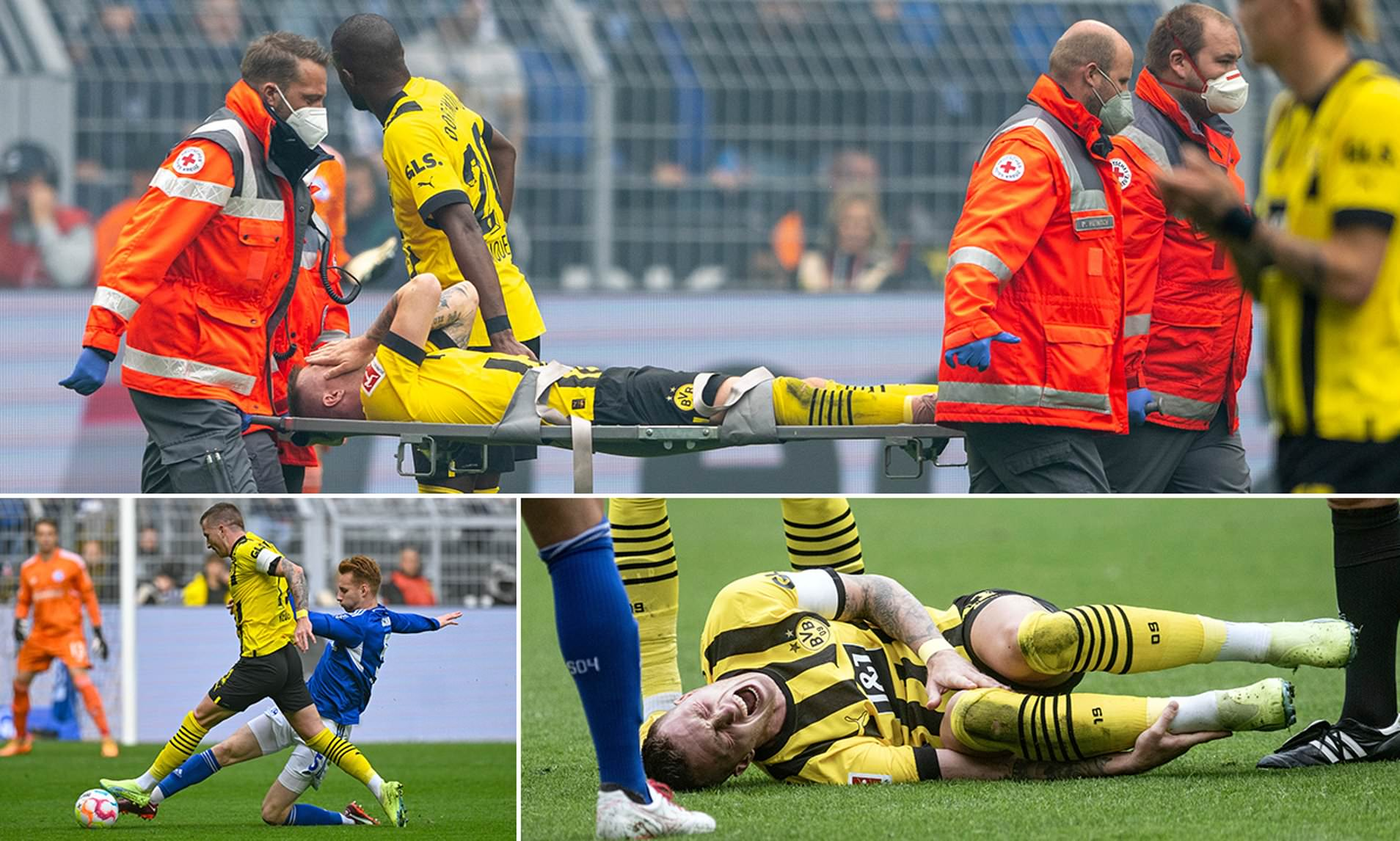 马尔科·罗伊斯意外受伤,休战一段时间的简单介绍 马尔科·罗伊斯意外受伤,休战一段时间的简单介绍